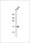 UBE2N Antibody (Center)